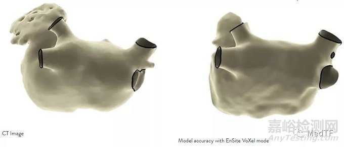 EnSite X EP：雅培最先進(jìn)的三維標(biāo)測獲FDA批準(zhǔn)