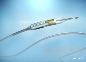 iRF Denervation:開啟去交感神經(jīng)治療糖尿病研究
