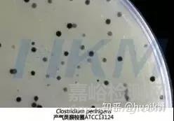 產(chǎn)氣莢膜梭菌檢驗注意事項