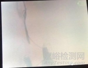 可視喉鏡靜電放電ESD整改案例分享