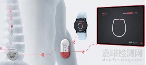 ONWARD脊髓電刺激:術(shù)后一天內(nèi)即可讓癱瘓患者(脊髓損傷)重新獨(dú)立行走