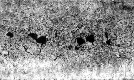 金屬材料質(zhì)量與缺陷介紹