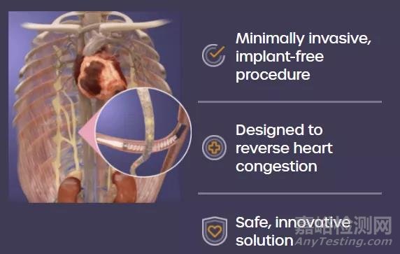 一種新型的消融導管---Satera