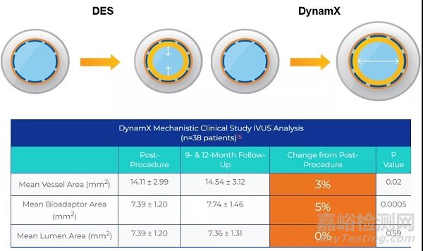 Dynamx ：一種術(shù)后可以松脫的冠脈支架