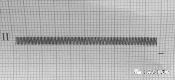 數(shù)字心電圖機內(nèi)部噪聲電平檢定中外部干擾信號的排除
