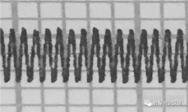 數(shù)字心電圖機內(nèi)部噪聲電平檢定中外部干擾信號的排除