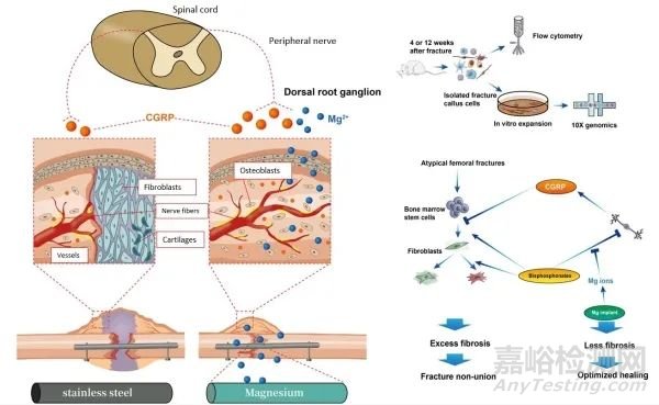 含鎂內(nèi)植入材料的骨科應(yīng)用研究獲進(jìn)展