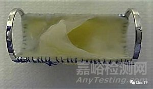 生物靜脈瓣VenoValve：公布FIM長期臨床結(jié)果 30月反流平均改善為 55%