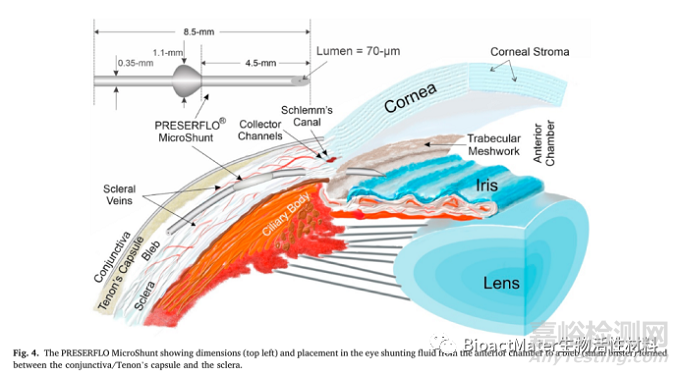 異丁烯聚合物在眼科方面的應(yīng)用