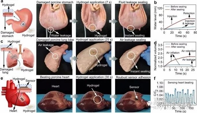 南大《Nature Commun》：超強水凝膠膠帶！縫合黑科技
