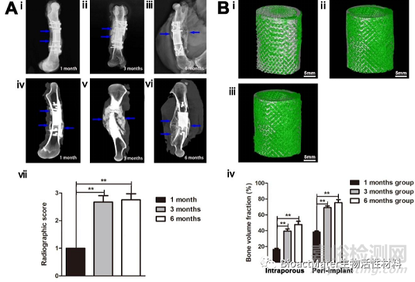 應(yīng)用3D打印多孔鈦合金內(nèi)植物橋接骨缺損區(qū)并成就內(nèi)植物-骨界面融合