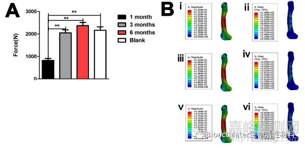 應(yīng)用3D打印多孔鈦合金內(nèi)植物橋接骨缺損區(qū)并成就內(nèi)植物-骨界面融合