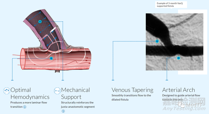 VasQ：血管外支架最大真實(shí)世界研究 證實(shí)長(zhǎng)期收益