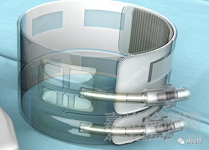 PH Band:具有超聲監(jiān)測功能的橈動脈止血器械 防止橈動脈閉塞
