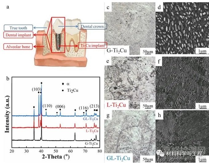 《Mater Des》：牙科用Ti-Cu合金的生物腐蝕行為和抗菌性能！