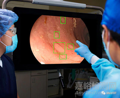 GI Genius:美敦力臨床研究證實人工智能輔助內鏡診斷能減少一半漏診