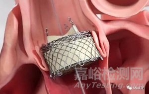 可回收的適用于反流的TAVR