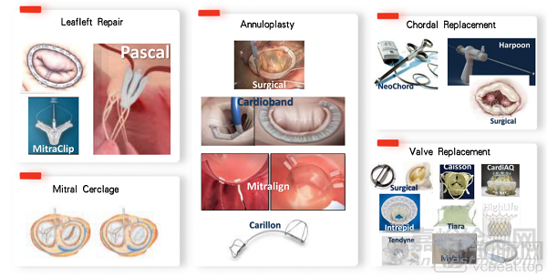 中國(guó)心臟瓣膜行業(yè)回顧、對(duì)比和展望