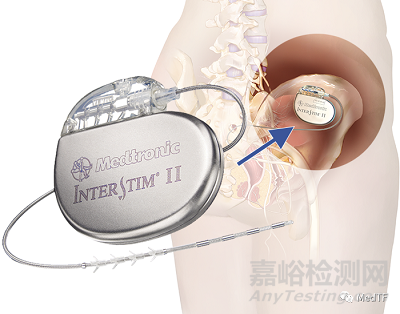 美敦力:開啟脛骨神經(jīng)刺激器臨床研究 優(yōu)化尿失禁治療方案