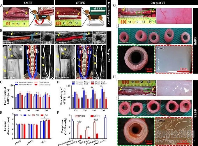南開大學孔德領：在人工血管研究方面取得進展