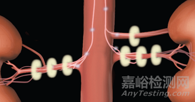 腎動(dòng)脈消融器械技術(shù)解析
