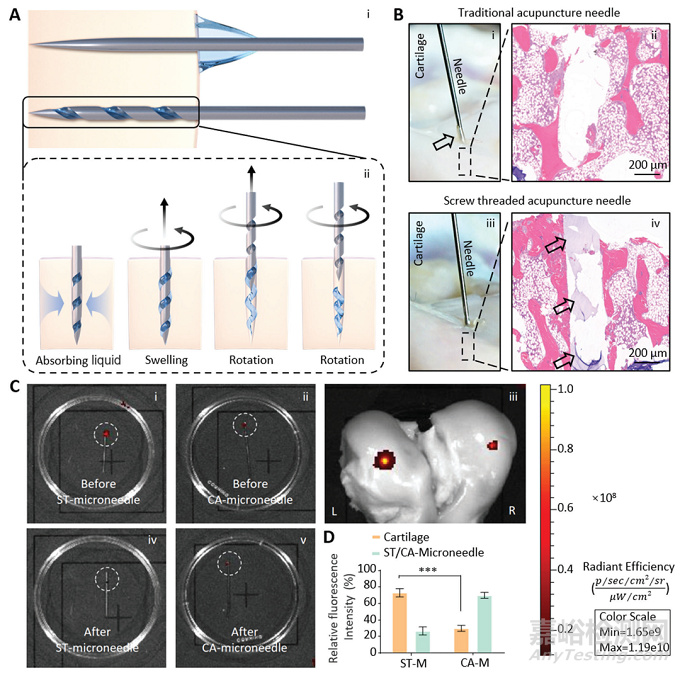 上海交大崔文國研發(fā)針灸針遞送水凝膠進(jìn)行病灶定位治療
