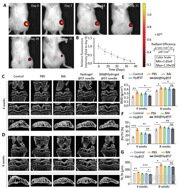 上海交大崔文國研發(fā)針灸針遞送水凝膠進(jìn)行病灶定位治療