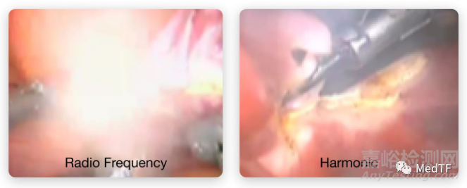 Ultrastat 3mm MiniLS：顛覆性的3mm超聲刀 閉合7mm血管