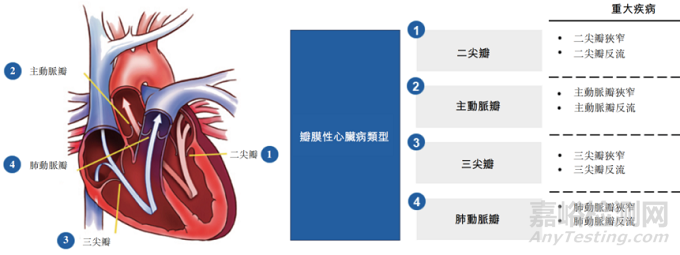 心臟瓣膜之二尖瓣技術(shù)解析