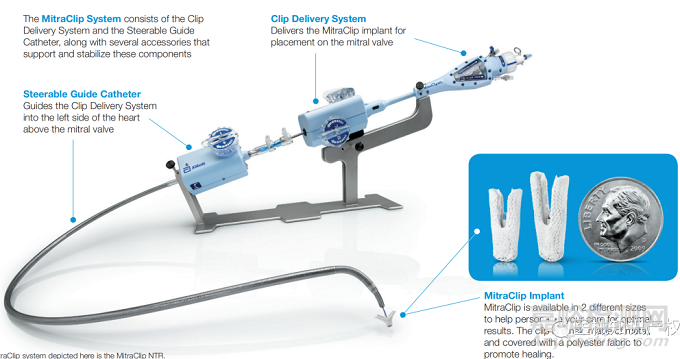 心臟瓣膜之二尖瓣技術(shù)解析
