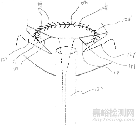心臟瓣膜之二尖瓣技術(shù)解析