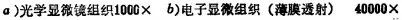 貝氏體的形成條件、組織形態(tài)和亞結(jié)構(gòu)