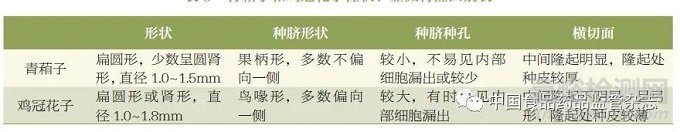 引用本文    連超杰，康帥＊，張南平，鄭健，馬雙成＊.《中國藥典》收載種子類藥材統(tǒng)計分析與監(jiān)管建議——以青葙子、雞冠花子為例[J].中國食品藥品監(jiān)管.2022.03（218）：25-33.