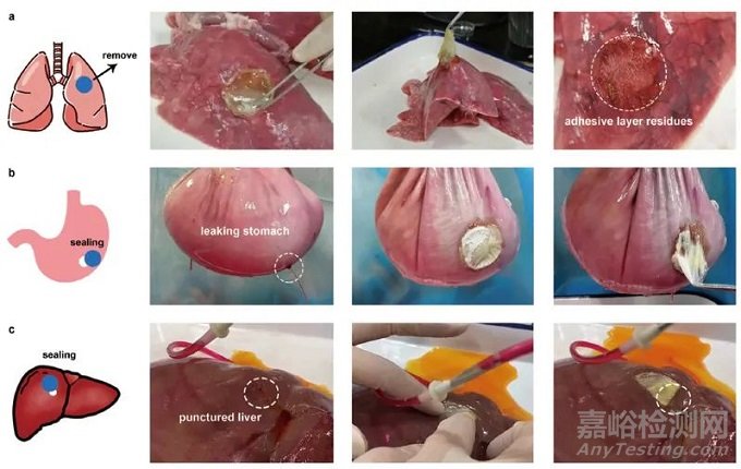 浙江大學(xué)首次設(shè)計(jì)出可代謝的免縫合光控自粘復(fù)軟組織創(chuàng)傷修復(fù)膜LAP