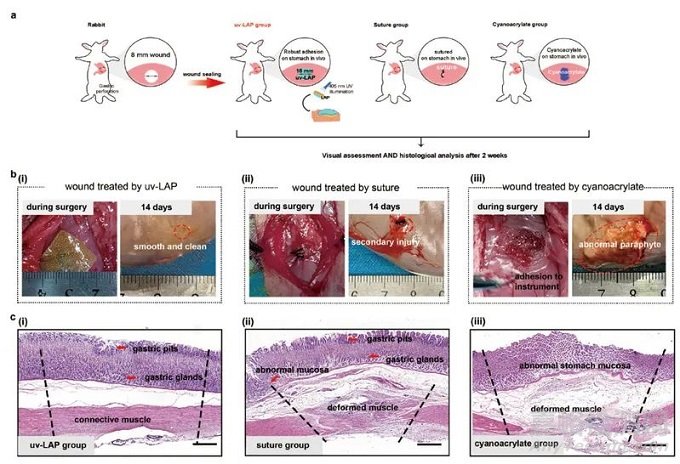 浙江大學(xué)首次設(shè)計(jì)出可代謝的免縫合光控自粘復(fù)軟組織創(chuàng)傷修復(fù)膜LAP