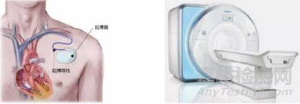 國(guó)產(chǎn)首個(gè)可兼容MRI的心臟起搏器產(chǎn)品獲批