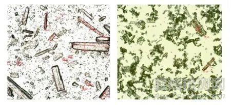 原料藥關(guān)鍵屬性及其對(duì)藥品開發(fā)的主要影響