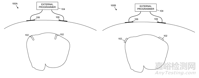  心臟起搏器專利分析報告（雅培篇）