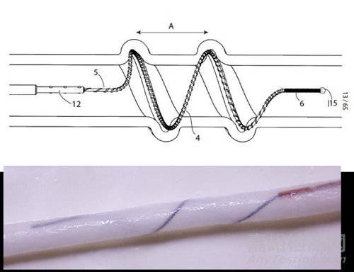 InVera：針對(duì)所有慢性靜脈疾病的微創(chuàng)、有效、無(wú)痛、快速的靜脈內(nèi)治療器械