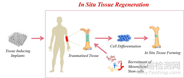 組織誘導(dǎo)性植入器械的作用原理與代表產(chǎn)品