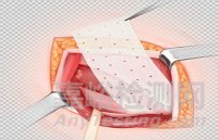 新型生物材料研發(fā)進展