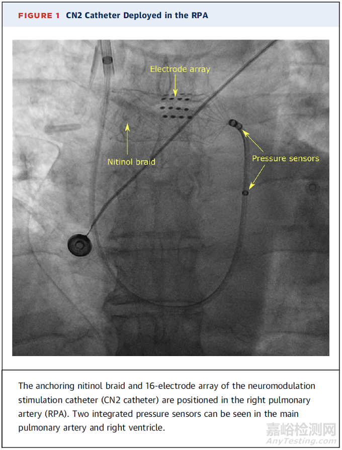 7款心力衰竭醫(yī)療器械新產(chǎn)品介紹