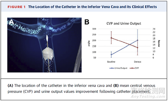 7款心力衰竭醫(yī)療器械新產(chǎn)品介紹