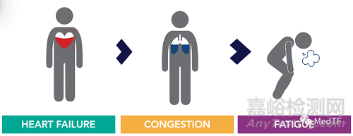 CPNS:心肺神經(jīng)刺激治療ADHF