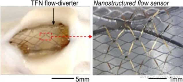 支架上的傳感器們