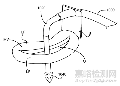 心臟瓣膜技術(shù)解析