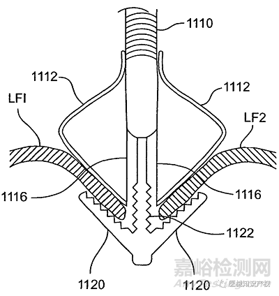 心臟瓣膜技術(shù)解析