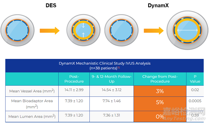 ?DynamX：研究顯示能隨血管旋轉(zhuǎn) 減少70%血管應(yīng)力