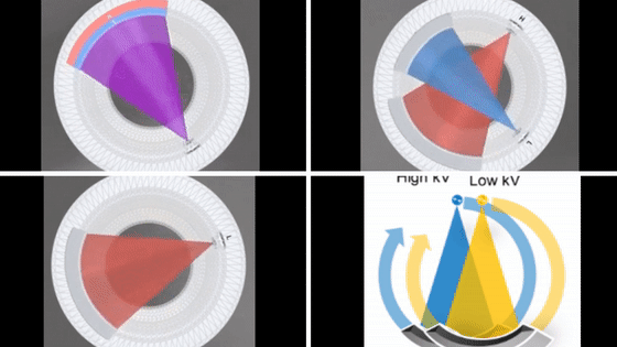 全球CT技術(shù)發(fā)展過程與趨勢