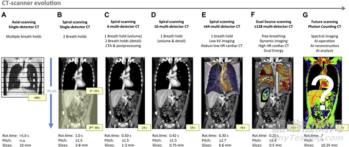 全球CT技術(shù)發(fā)展過程與趨勢